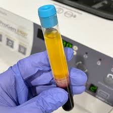 Best treatments for your skin Chicago