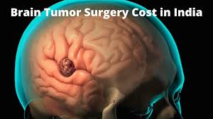 Brain Tumor Surgery Cost in India