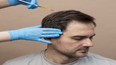 Hair Transplant Doctor in Kolkata