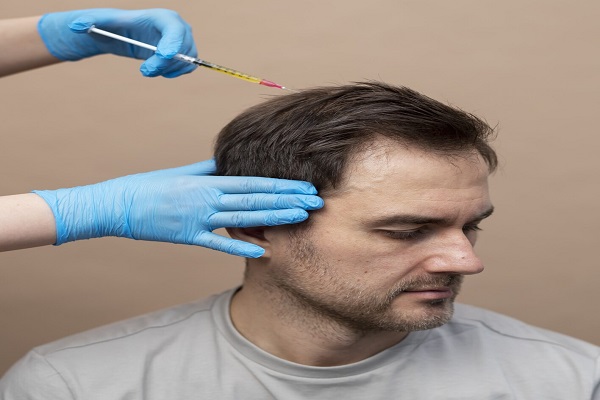 Hair Transplant Doctor in Kolkata