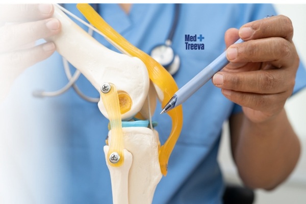 Robotic Knee Replacement Surgery