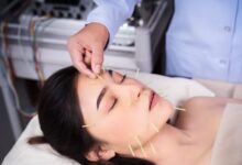 Thread Lift Treatment
