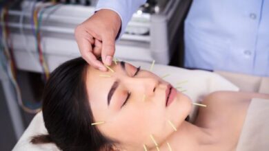 Thread Lift Treatment